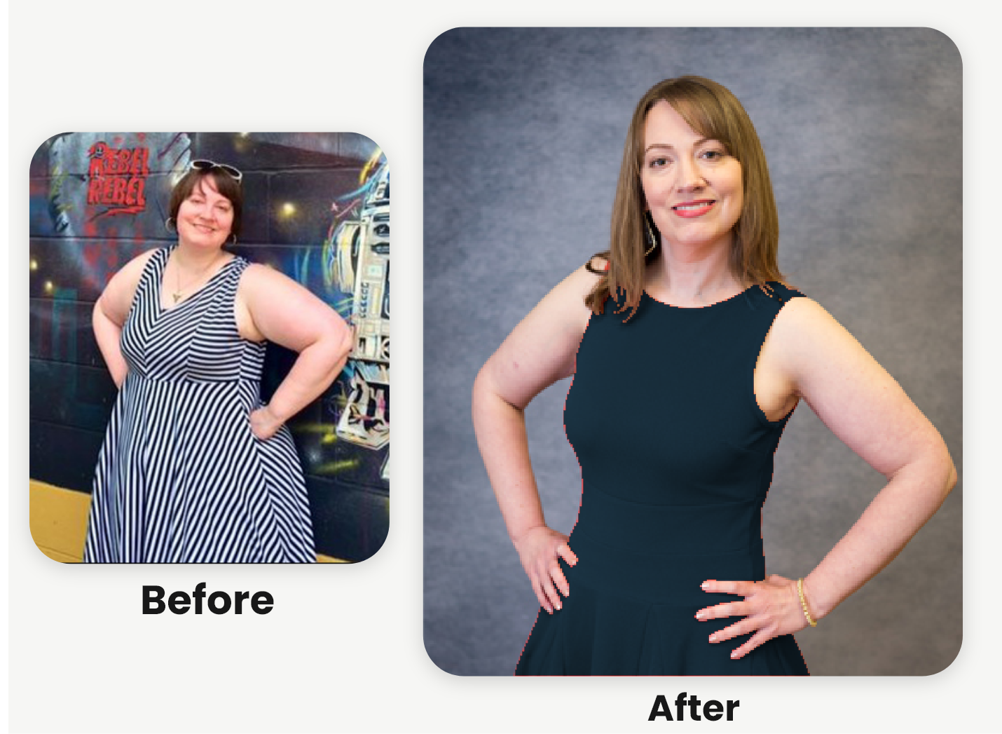 Meredith, an actual NuSelf patient, before and after treatment